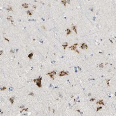 Immunohistochemistry-Paraffin: B4GALNT1 Antibody [NBP1-88662]