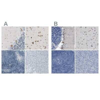 Immunohistochemistry-Paraffin: B4GALNT1 Antibody [NBP1-88662]