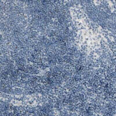 Immunohistochemistry-Paraffin: B4GALNT1 Antibody [NBP1-88662]