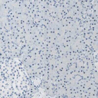 Immunohistochemistry-Paraffin: B4GALNT1 Antibody [NBP1-88662]