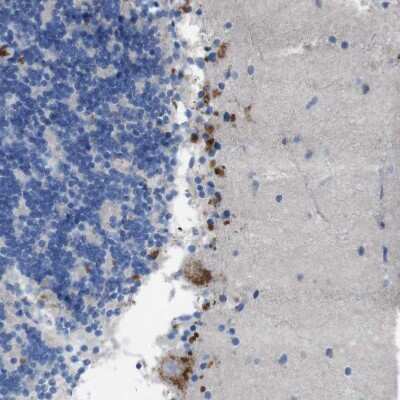 Immunohistochemistry-Paraffin: B4GALNT1 Antibody [NBP1-88663]