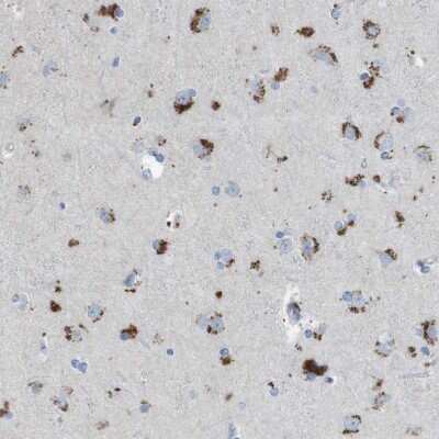 Immunohistochemistry-Paraffin: B4GALNT1 Antibody [NBP1-88663]