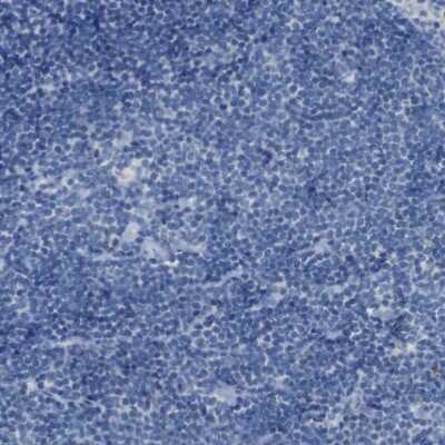 Immunohistochemistry-Paraffin: B4GALNT1 Antibody [NBP1-88663]