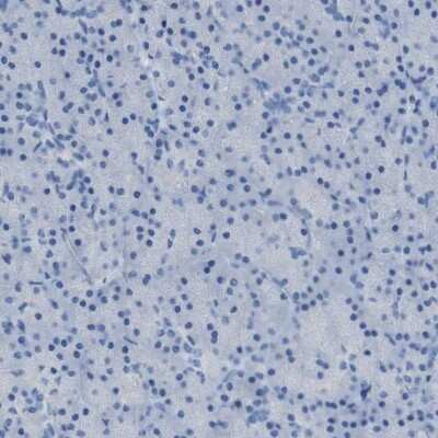 Immunohistochemistry-Paraffin: B4GALNT1 Antibody [NBP1-88663]