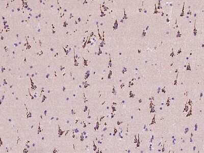 Immunohistochemistry-Paraffin: B4GALNT1 Antibody [NBP2-97401]