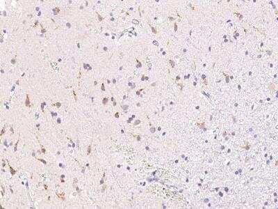 Immunohistochemistry-Paraffin: B4GALNT1 Antibody [NBP2-98806]