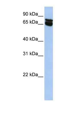 Western Blot: B4GALNT1 Antibody [NBP1-62535]