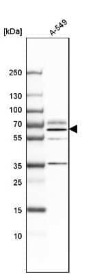 Western Blot: B4GALNT1 Antibody [NBP1-88662]