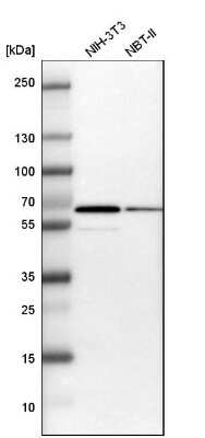 Western Blot: B4GALNT1 Antibody [NBP1-88662]