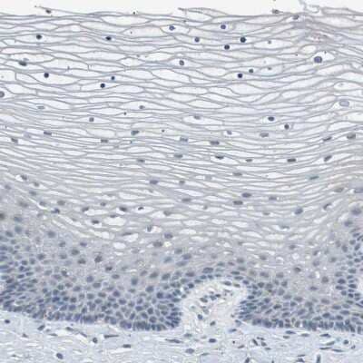 Immunohistochemistry-Paraffin: B4GALNT2 Antibody [NBP1-91229]