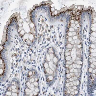 Immunohistochemistry-Paraffin: B4GALNT2 Antibody [NBP1-91229]