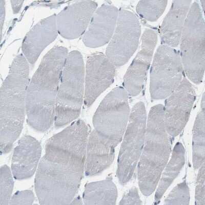Immunohistochemistry-Paraffin: B4GALNT2 Antibody [NBP1-91229]