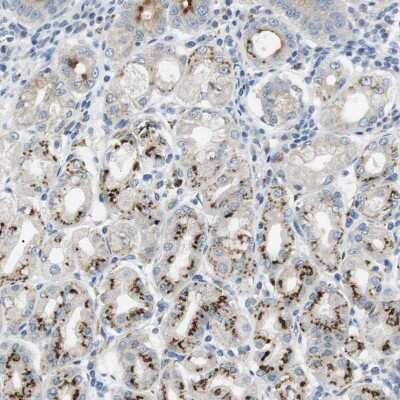 Immunohistochemistry-Paraffin: B4GALNT2 Antibody [NBP1-91229]