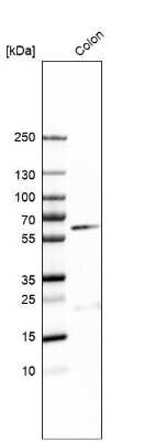 Western Blot: B4GALNT2 Antibody [NBP1-91229]