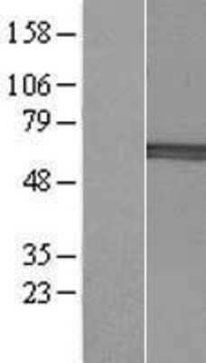 Western Blot: B4GALNT2 Overexpression Lysate [NBP2-05249]