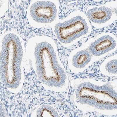 Immunohistochemistry-Paraffin: B4GALNT3 Antibody [NBP1-90836]