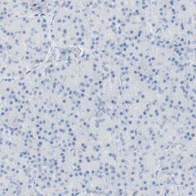 Immunohistochemistry-Paraffin: B4GALNT3 Antibody [NBP1-90836]