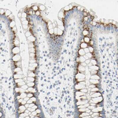 Immunohistochemistry-Paraffin: B4GALNT3 Antibody [NBP1-90836]