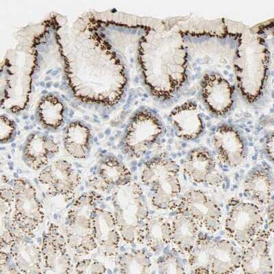 Immunohistochemistry-Paraffin: B4GALNT3 Antibody [NBP1-90836]