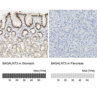 Immunohistochemistry-Paraffin: B4GALNT3 Antibody [NBP1-90836]