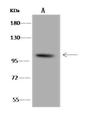 Western Blot: B4GALNT3 Antibody [NBP3-06340]