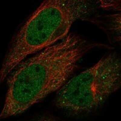 Immunocytochemistry/ Immunofluorescence: B4GALNT4 Antibody [NBP3-17151]