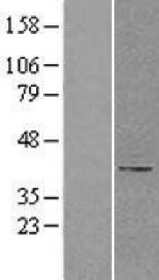 Western Blot: beta-1,4-Galactosyltransferase 1/B4GalT1 Overexpression Lysate [NBL1-07888]