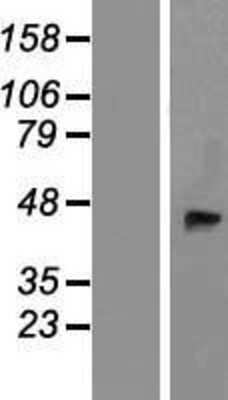 Western Blot: beta-1,4-Galactosyltransferase 2/B4GalT2 Overexpression Lysate [NBP2-07956]