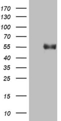 Western Blot: B4GALT3 Antibody (OTI1G9) [NBP2-46561]