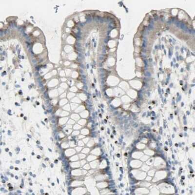 Immunohistochemistry-Paraffin: B4GALT3 Antibody [NBP1-88653]