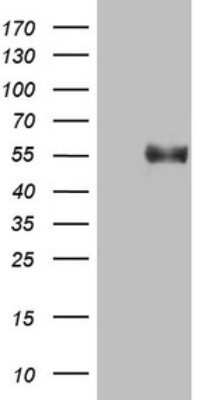 Western Blot: B4GALT3 Antibody (OTI1G9)Azide and BSA Free [NBP2-71386]