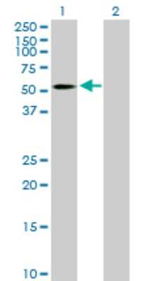 Western Blot: B4GALT3 Antibody [H00008703-B01P]