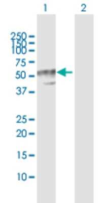 Western Blot: B4GALT3 Antibody [H00008703-D01P]