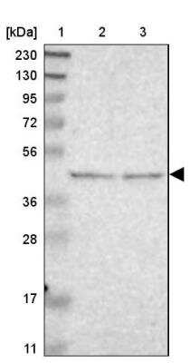 Western Blot: B4GALT3 Antibody [NBP1-88653]