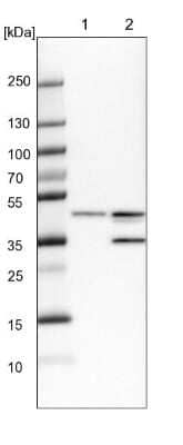 Western Blot: B4GALT3 Antibody [NBP1-88653]