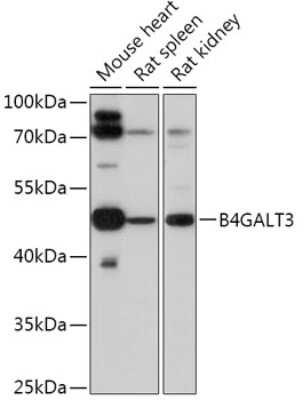 Western Blot: B4GALT3 AntibodyAzide and BSA Free [NBP2-92764]