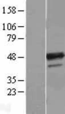 Western Blot: B4GALT3 Overexpression Lysate [NBL1-07889]