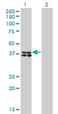 Western Blot: B4GALT4 Antibody (5E2) [H00008702-M01]