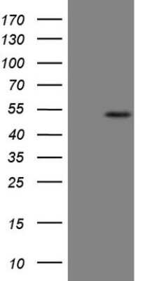 Western Blot: B4GALT4 Antibody (OTI8B6) [NBP2-46562]