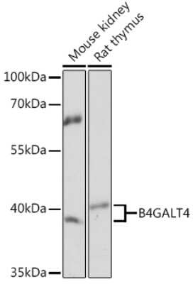 Western Blot: B4GALT4 AntibodyAzide and BSA Free [NBP3-15515]