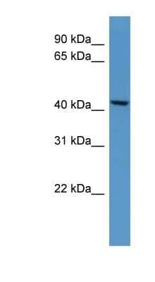 Western Blot: B4GALT5 Antibody [NBP1-69018]