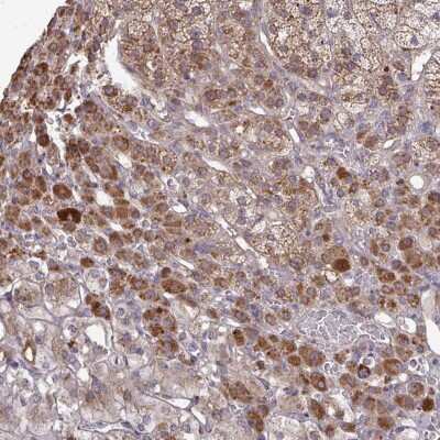 Immunohistochemistry: B4GALT6 Antibody [NBP2-37967]