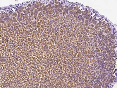 Immunohistochemistry-Paraffin: B4GALT6 Antibody [NBP2-99252]