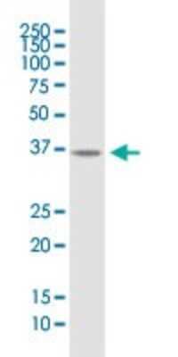 Western Blot: B4GALT7 Antibody [H00011285-B01P]