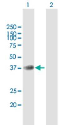 Western Blot: B4GALT7 Antibody [H00011285-B01P]