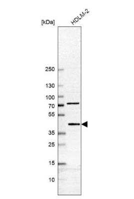 Western Blot: B4GALT7 Antibody [NBP1-88652]