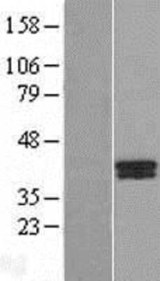 Western Blot: B4GALT7 Overexpression Lysate [NBL1-07891]