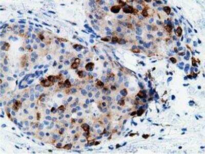 Immunohistochemistry-Paraffin: B7-1/CD80 Antibody (OTI2E5) [NBP2-02905]