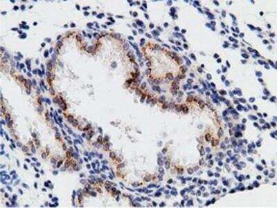Immunohistochemistry-Paraffin: B7-1/CD80 Antibody (OTI2E5) [NBP2-02905]