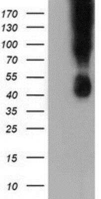 Western Blot: B7-1/CD80 Antibody (OTI2E5) [NBP2-02905]